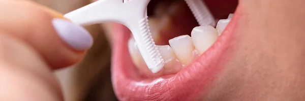 Close Woman Hand Cleaning Teeth Dental Floss — Stock Photo, Image