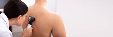 Erkek Sırtındaki Pigmentli Deriyi Dermatoskopla İnceleyen Kadın Doktor