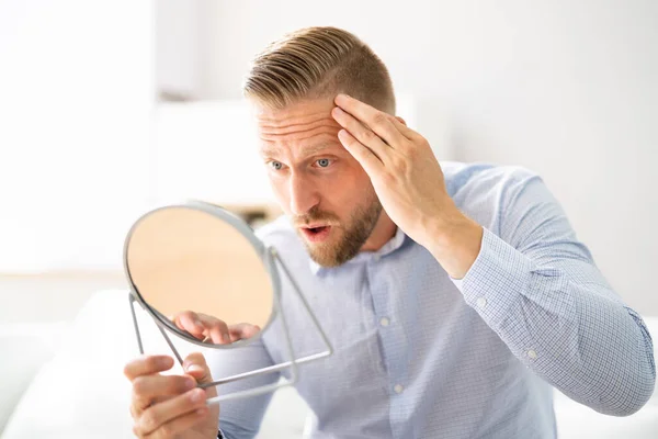 Alopecia Hombre Pérdida Cabello Desesperación Estrés Emocional — Foto de Stock