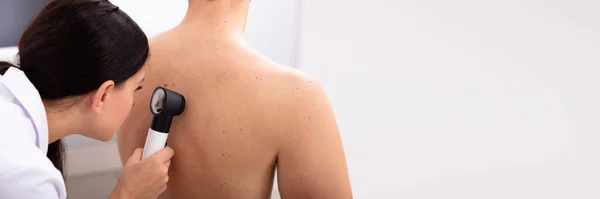 Médico Femenino Examinando Piel Pigmentada Espalda Del Hombre Con Dermatoscopio —  Fotos de Stock