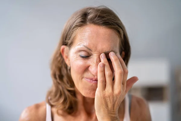 Oog Brandende Pijn Spasme Vermoeidheid Staar Symptomen — Stockfoto