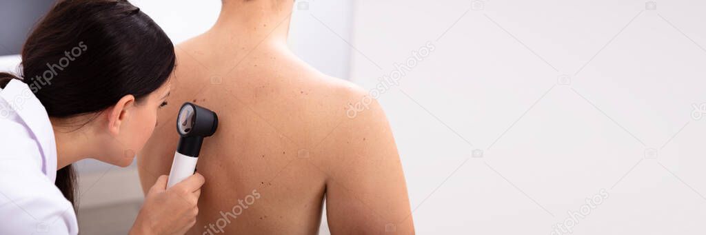 Female Doctor Examining Pigmented Skin On Man's Back With Dermatoscope