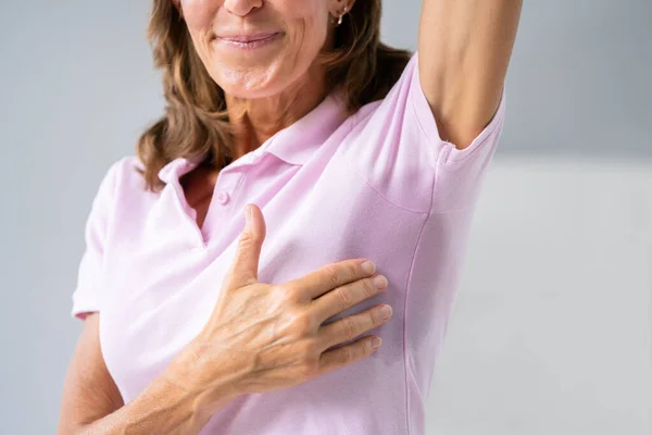 Mulher Com Hiperidrose Suando Muito Mal Sob Axila — Fotografia de Stock