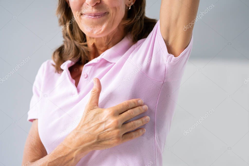 Woman With Hyperhidrosis Sweating Very Badly Under Armpit