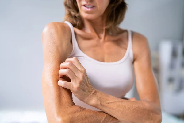 Woman Itchy Skin Allergy Psoriasis — Stok fotoğraf