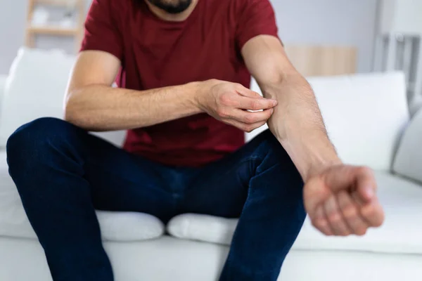 Man Itchy Skin Allergy Psoriasis — Stok fotoğraf