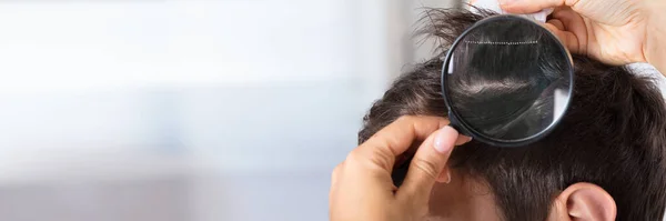 Dermatolog Saç Biti Saç Dökülmesini Kontrol Ediyor — Stok fotoğraf
