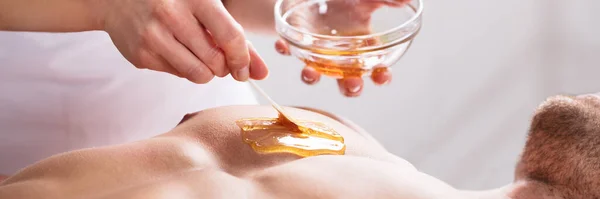 Wax Hair Removal. Waxing Male Chest At Spa