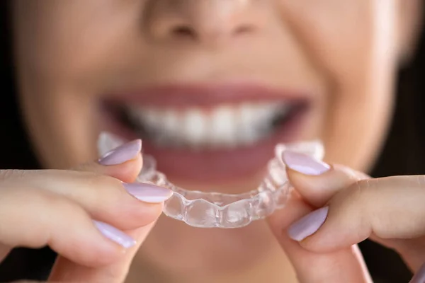 Clear Aligner Stomatologia Nocna Dla Zębów — Zdjęcie stockowe