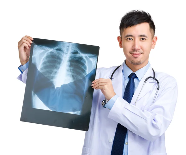 Doctor holding X-ray — Stock Photo, Image