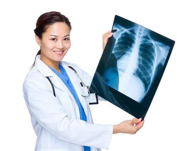 Женщина-врач держит рентгеновский фильм — стоковое фото