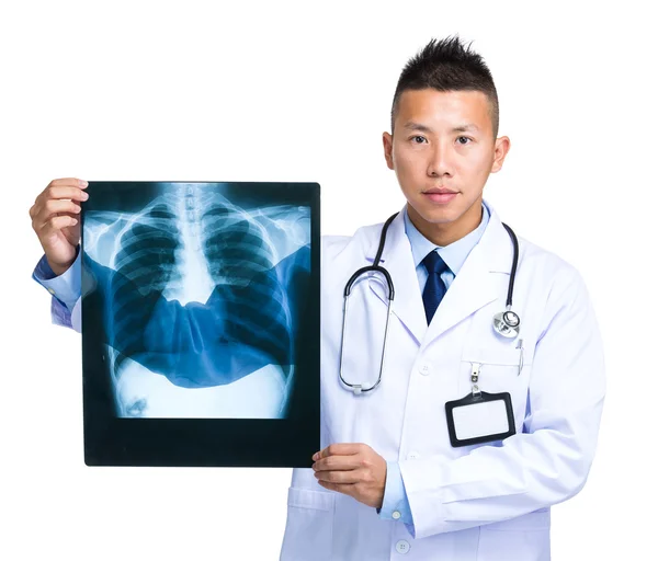 Лікар тримає з рентгенівським випромінюванням — стокове фото