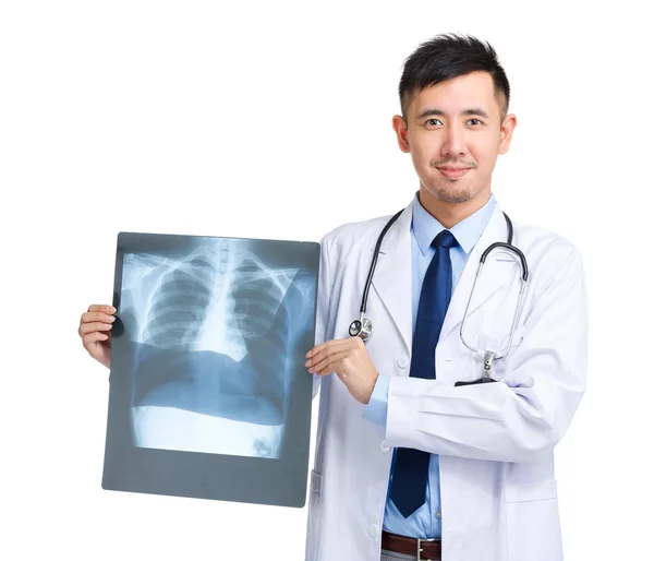 Лікар тримає з рентгенівським випромінюванням — стокове фото