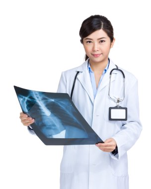 Doctor with x ray film of chest lung clipart