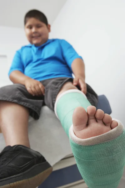 Niño con la pierna en yeso Reparto —  Fotos de Stock