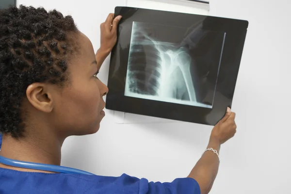 Doctor Examining An X-Ray Report — Stock Photo, Image