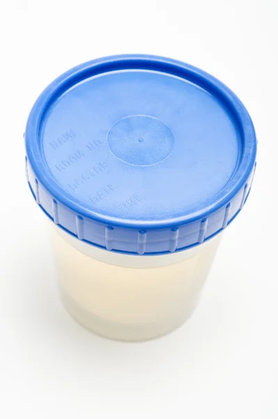 Amostra de urina em recipiente de plástico — Fotografia de Stock
