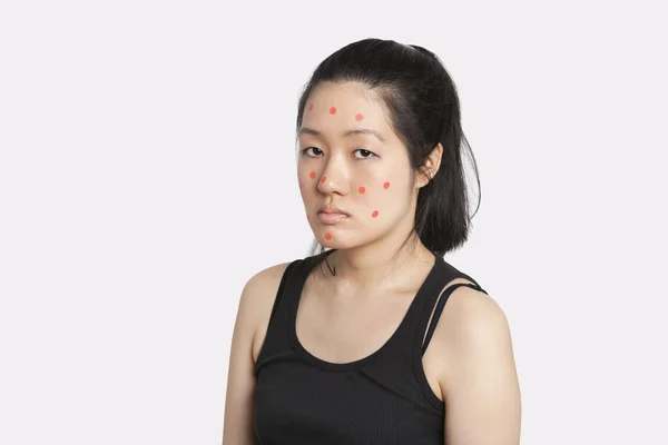 Portrait of an young woman suffering from measles — Stock Photo, Image