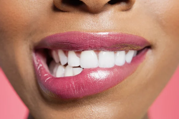 Vista de cerca de una hembra mordiendo su labio rojo sobre el fondo de color —  Fotos de Stock