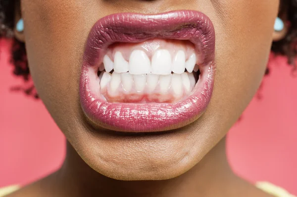 Detalle de la mujer apretando los dientes — Foto de Stock