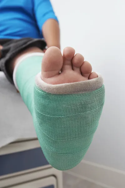 Boy's Leg In Plaster Cast — Stock Photo, Image