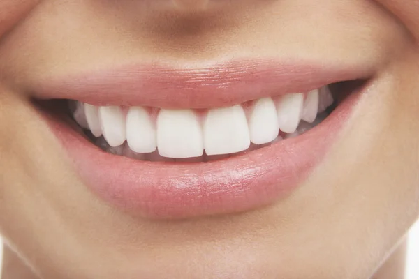 Открытый рот женщины идеальные зубы — стоковое фото