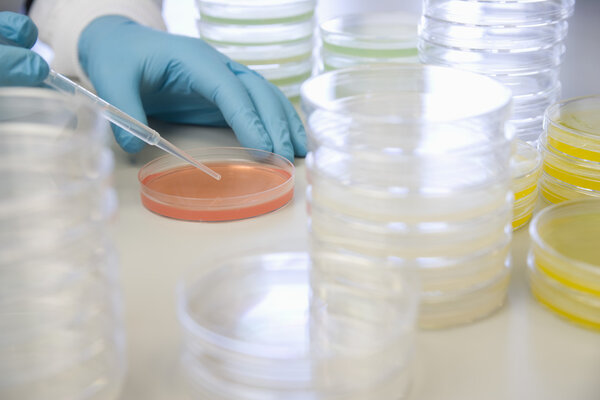 scientist hands with Petri dishes