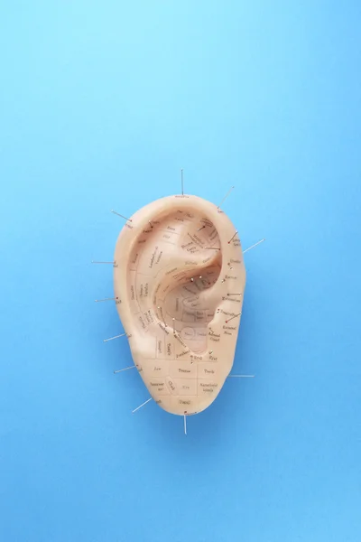 Alfileres de acupuntura en oreja modelo —  Fotos de Stock