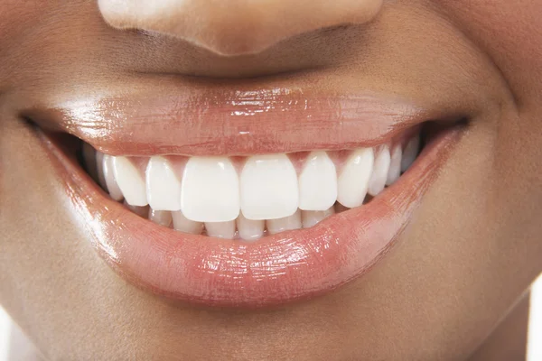 A boca aberta da mulher dentes perfeitos — Fotografia de Stock