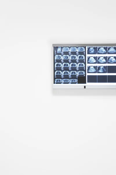 Röntgen- und Ultraschall-Ergebnisse — Stockfoto