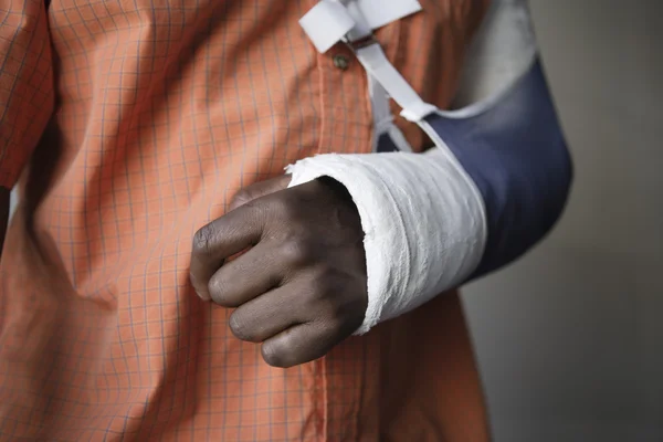 Man met gebroken arm — Stockfoto