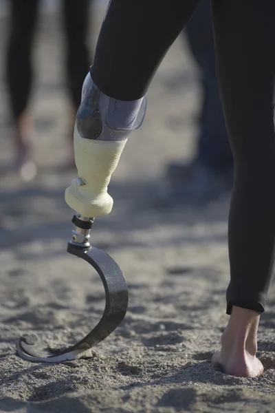 Person med protetiska ben — Stockfoto