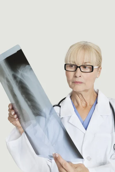 Female doctor examining x-ray Stock Photo