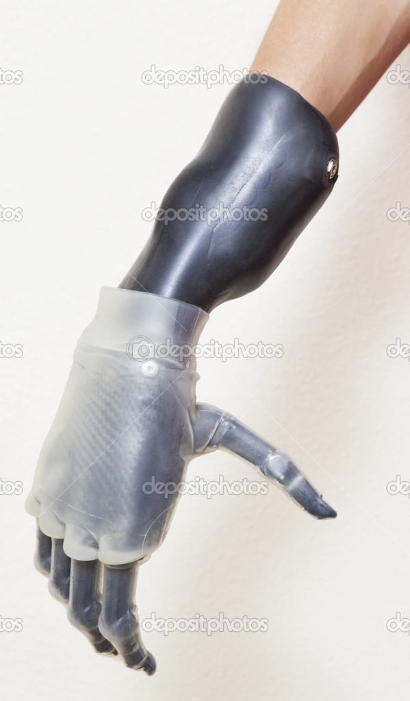 Man's prosthetic hand