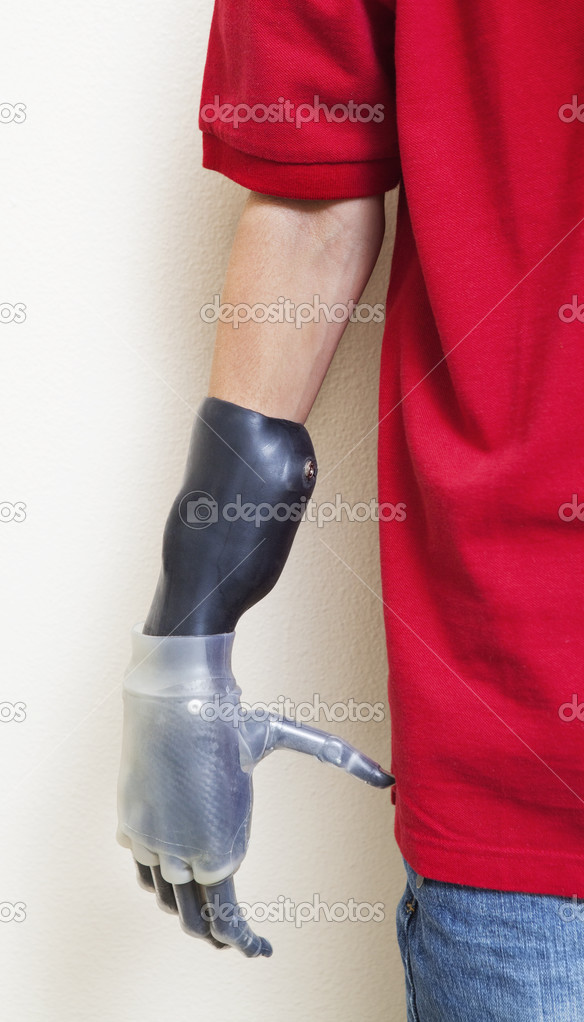 Man with prosthetic hand