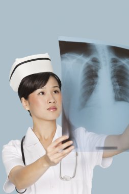 Doktor Röntgen rapor analiz