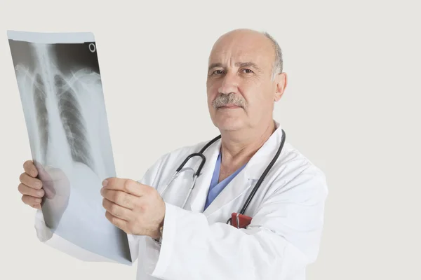 Doctor holding medical radiograph — Stock Photo, Image