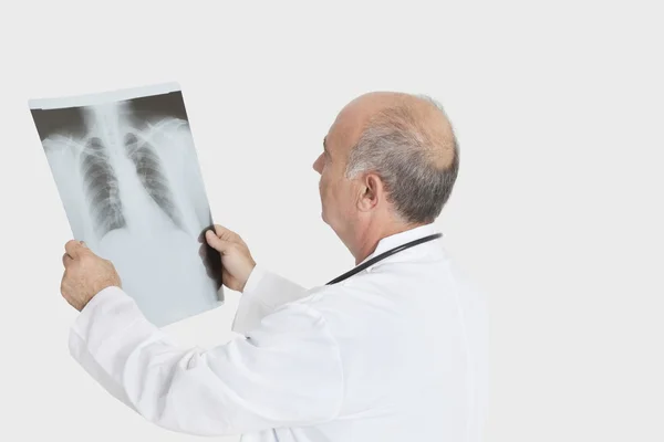 Γιατρός εξετάζει ιατρική ακτινογραφία — Φωτογραφία Αρχείου
