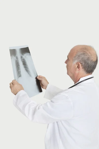 Médico examinando radiografia médica — Fotografia de Stock