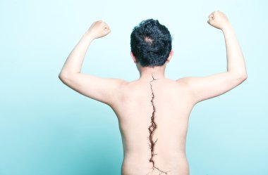 omurga üzerinde çıplak sırt ile a çatlamak