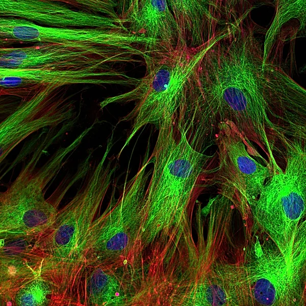 Фибробласты (клетки кожи), помеченные флуоресцентными красителями — стоковое фото