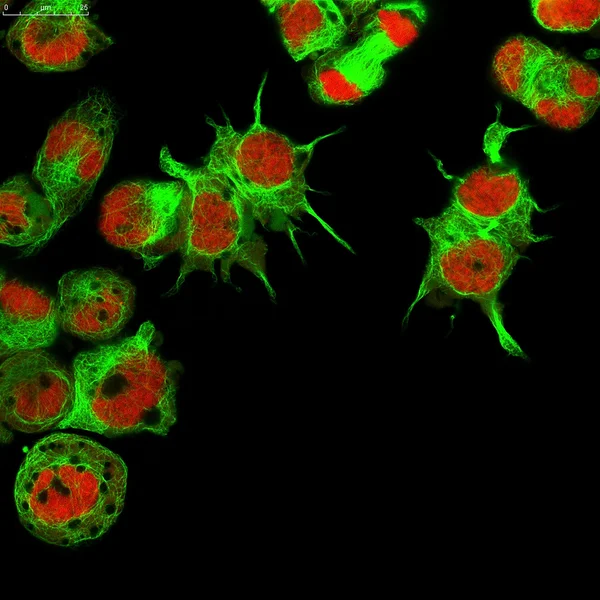 Tło z komórek nowotworowych fluorescencyjne — Zdjęcie stockowe