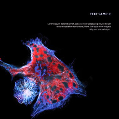 epitelyal tümör hücreleri floresan molekülleri ile Etiketlenmiş
