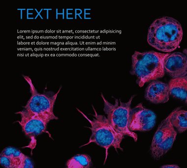 Background with fluorescent cancer cells clipart