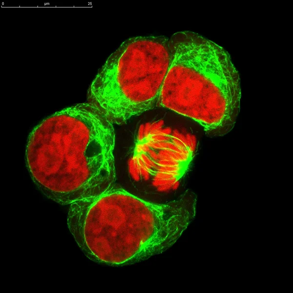 Linha celular de leucose marcada com corantes fluorescentes. Uma célula em divisão — Fotografia de Stock