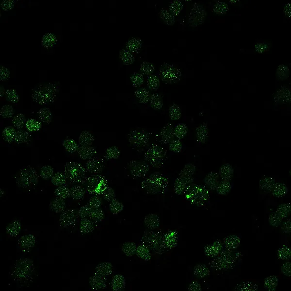 Fibroblastos irradiados de la piel —  Fotos de Stock