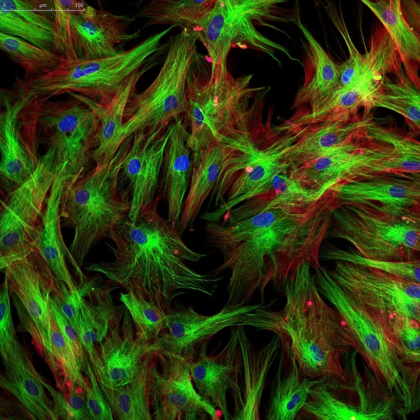 Fibroblasten (Hautzellen) mit fluoreszierenden Farbstoffen markiert — Stockfoto