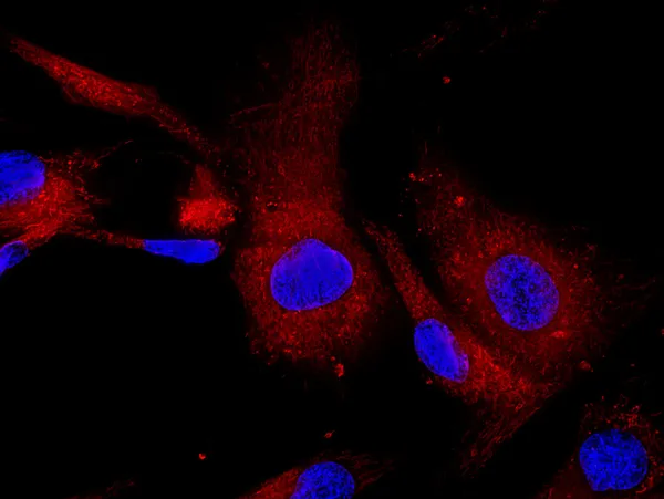 Mezenkimal Kök hücre floresan molekülleri ile Etiketlenmiş