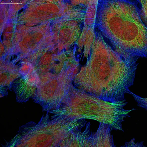 Fibroblasti (cellule della pelle) etichettati con coloranti fluorescenti — Foto Stock