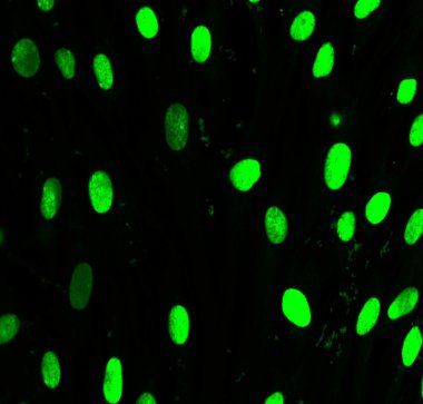 Fibroblasts nucleus labeled with green fluorescent dye clipart